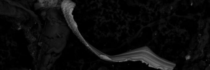 Identifying Abnormal Vs. Normal Wear